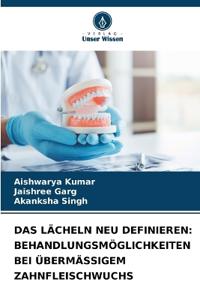 Das Lächeln Neu Definieren: Behandlungsmöglichkeiten Bei Übermässigem Zahnfleischwuchs