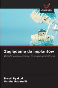 Zagladanie do implantów