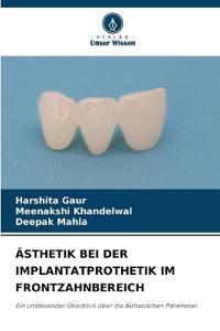 Ästhetik Bei Der Implantatprothetik Im Frontzahnbereich