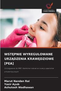 WstĘpnie Wyregulowane UrzĄdzenia KrawĘdziowe [Pea]