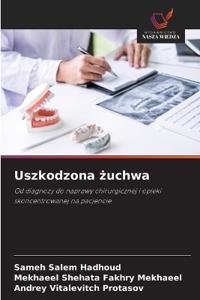 Uszkodzona zuchwa