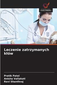 Leczenie zatrzymanych klów
