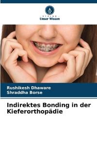 Indirektes Bonding in der Kieferorthopädie