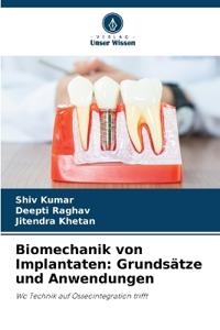 Biomechanik von Implantaten