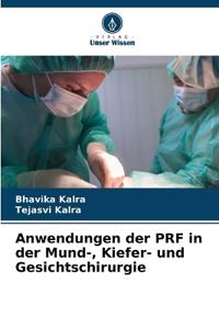 Anwendungen der PRF in der Mund-, Kiefer- und Gesichtschirurgie