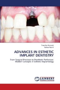 Advances in Esthetic Implant Dentistry