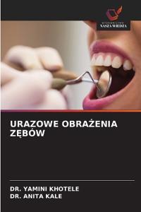 Urazowe ObraZenia ZEbów