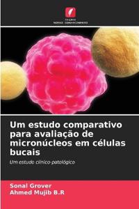 Um estudo comparativo para avaliação de micronúcleos em células bucais