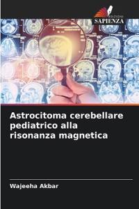 Astrocitoma cerebellare pediatrico alla risonanza magnetica