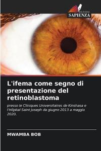 L'ifema come segno di presentazione del retinoblastoma