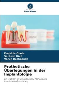 Prothetische Überlegungen in der Implantologie