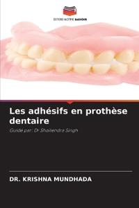Les adhésifs en prothèse dentaire