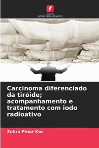 Carcinoma diferenciado da tiróide; acompanhamento e tratamento com iodo radioativo