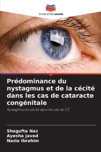 Prédominance du nystagmus et de la cécité dans les cas de cataracte congénitale
