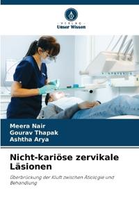 Nicht-kariöse zervikale Läsionen