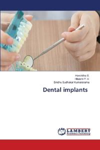 Dental implants