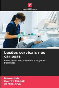 Lesões cervicais não cariosas