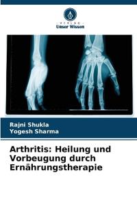 Arthritis