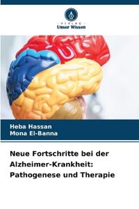 Neue Fortschritte bei der Alzheimer-Krankheit