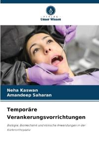 Temporäre Verankerungsvorrichtungen