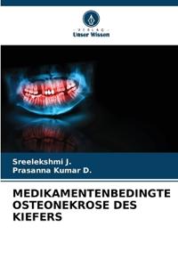 MEDIKAMENTENBEDINGTE OSTEONEKROSE DES KIEFERS
