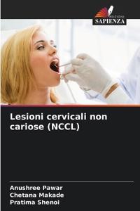 Lesioni cervicali non cariose (NCCL)