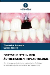 FORTSCHRITTE IN DER ÄSTHETISCHEN IMPLANTOLOGIE