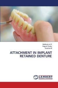 Attachment in Implant Retained Denture