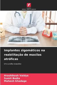 Implantes zigomáticos na reabilitação de maxilas atróficas