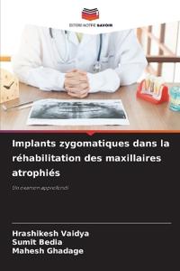 Implants zygomatiques dans la réhabilitation des maxillaires atrophiés