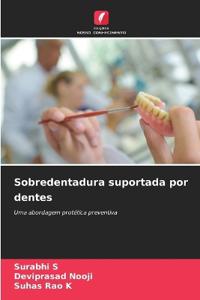 Sobredentadura suportada por dentes