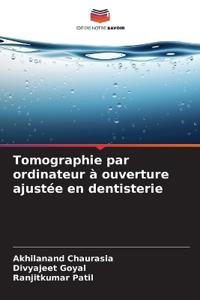 Tomographie par ordinateur à ouverture ajustée en dentisterie