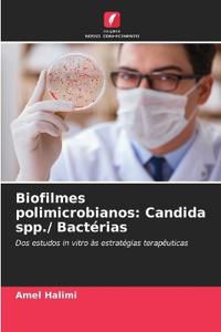 Biofilmes polimicrobianos