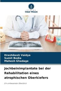 Jochbeinimplantate bei der Rehabilitation eines atrophischen Oberkiefers
