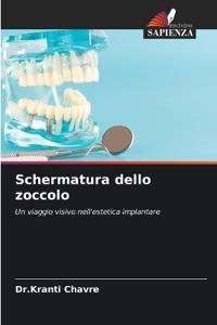 Schermatura dello zoccolo