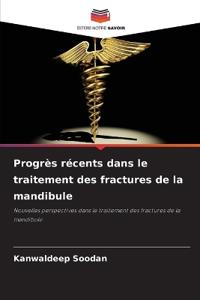 Progrès récents dans le traitement des fractures de la mandibule