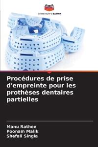 Procédures de prise d'empreinte pour les prothèses dentaires partielles