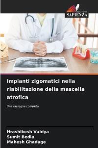 Impianti zigomatici nella riabilitazione della mascella atrofica