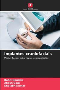Implantes craniofaciais
