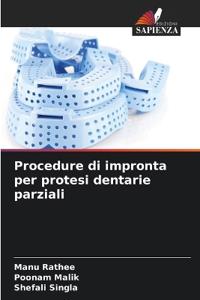 Procedure di impronta per protesi dentarie parziali
