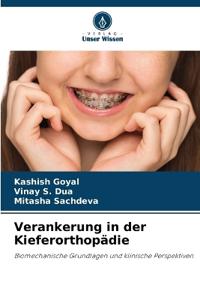 Verankerung in der Kieferorthopädie