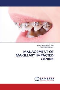 Management of Maxillary Impacted Canine
