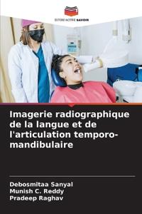 Imagerie radiographique de la langue et de l'articulation temporo-mandibulaire