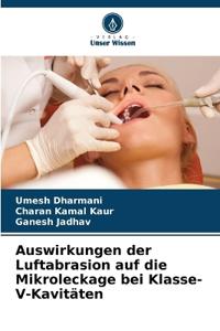 Auswirkungen der Luftabrasion auf die Mikroleckage bei Klasse-V-Kavitäten