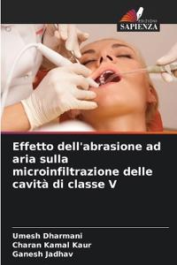 Effetto dell'abrasione ad aria sulla microinfiltrazione delle cavità di classe V