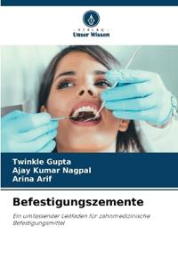 Befestigungszemente