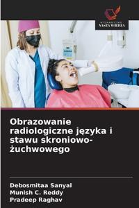Obrazowanie radiologiczne języka i stawu skroniowo-żuchwowego