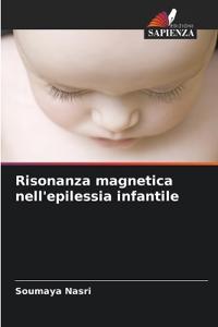 Risonanza magnetica nell'epilessia infantile