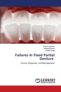 Failures in Fixed Partial Denture