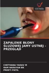 Zapalenie Blony Śluzowej Jamy Ustnej - PrzeglĄd